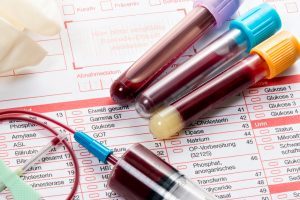 Blood samples and test tubes on a medical form.