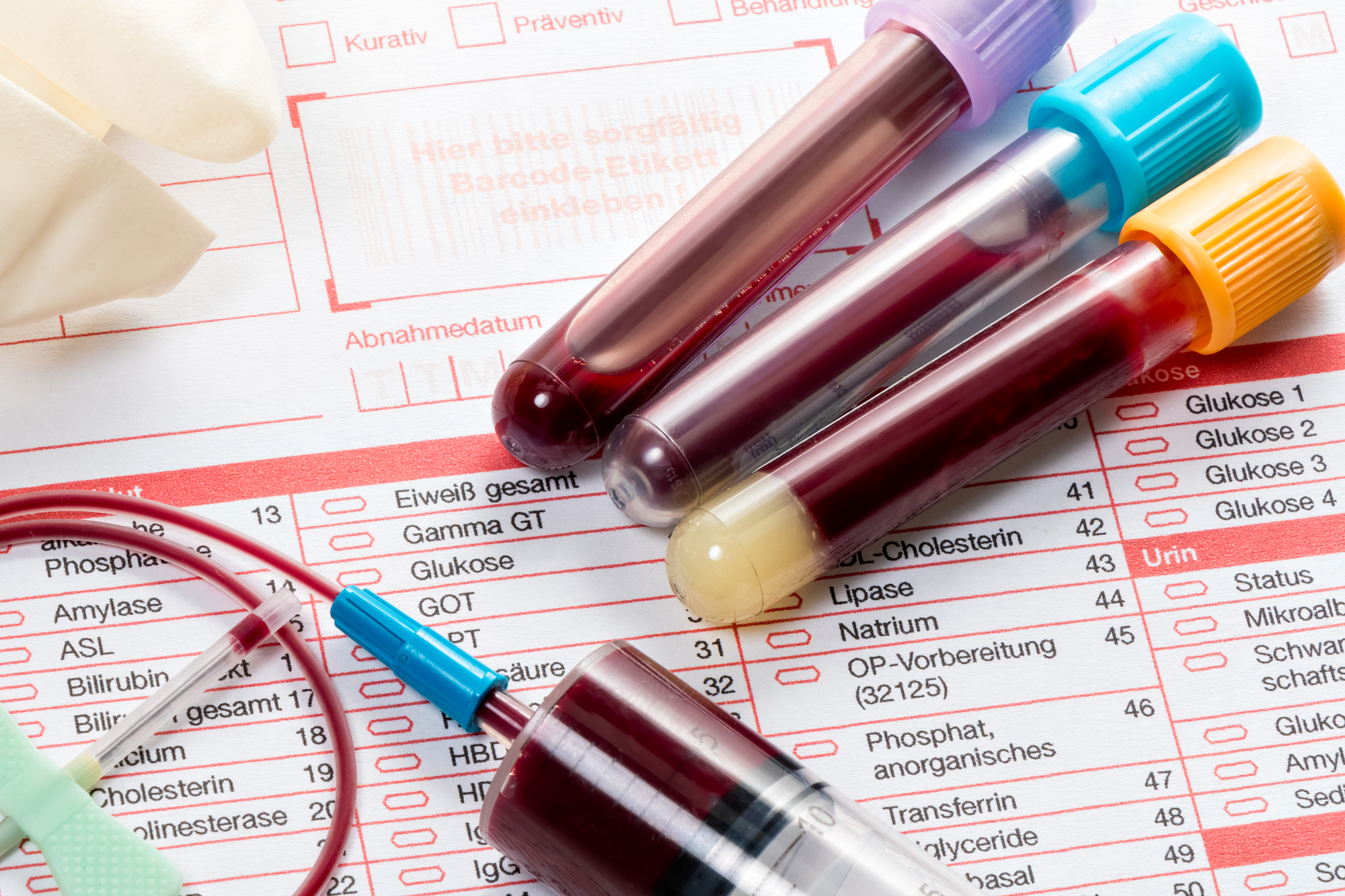 Blood test, blood samples on a laboratory form TrueTest Labs